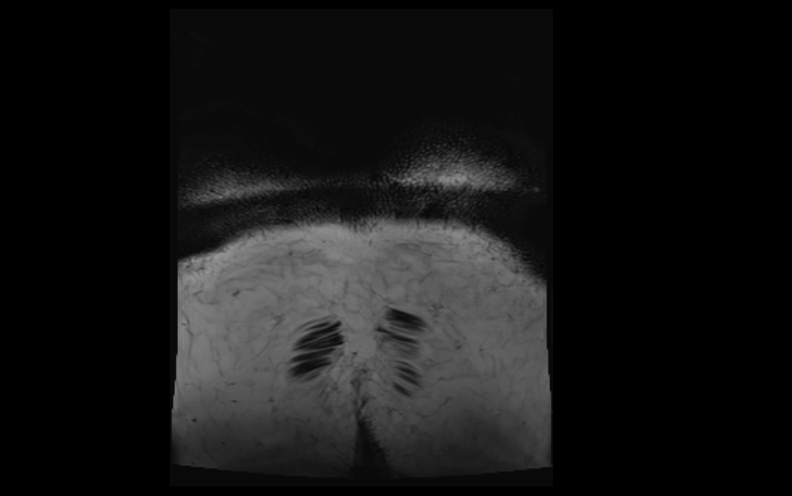 MR lumbosacral plexus cross sectional anatomy 3T  radiology  image-img-09001-00095.webp